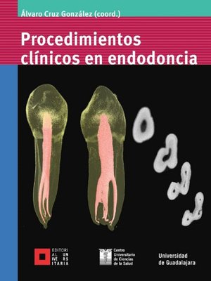 cover image of Procedimientos clínicos en endodoncia